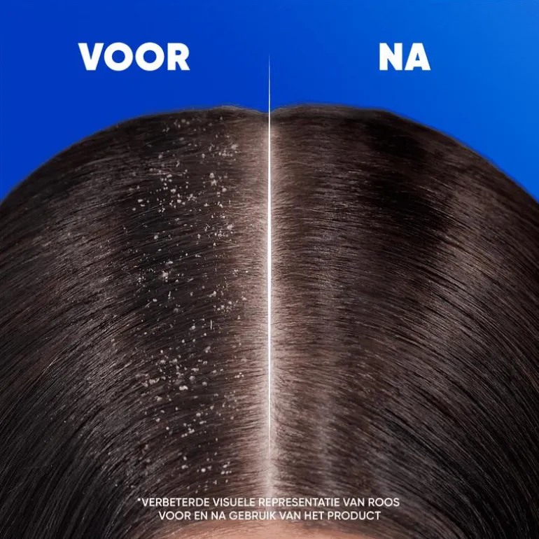 Head & Shoulders Apple Fresh Anti-Roos Shampoo 300 ML