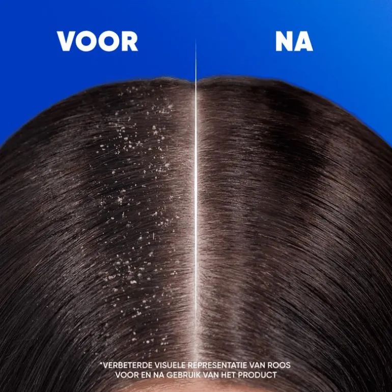 Head & Shoulders Classic Anti-roos Shampoo 625 ML