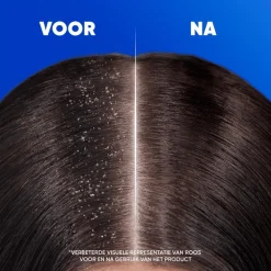 Head & Shoulders Classic 2in1 Anti-roos Shampoo & Conditioner 300 ML