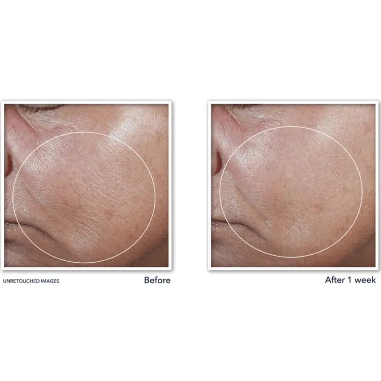 RoC Derm Correxion Firming Serum Stick